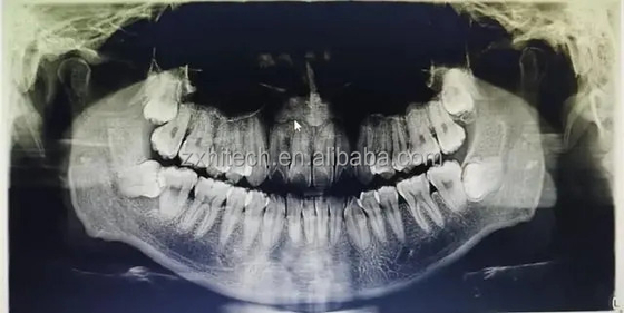 Dental CT 3D CBCT Digitale röntgenapparatuur China